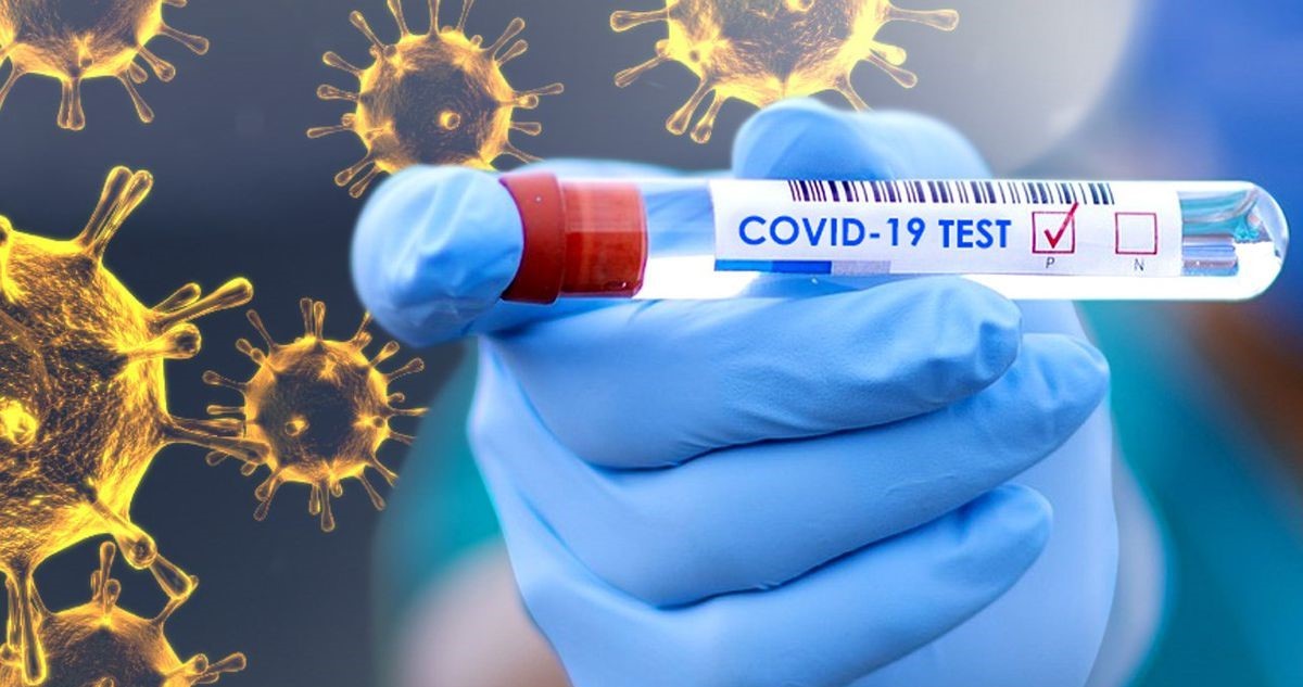 Stock photo of COVID-19 Test