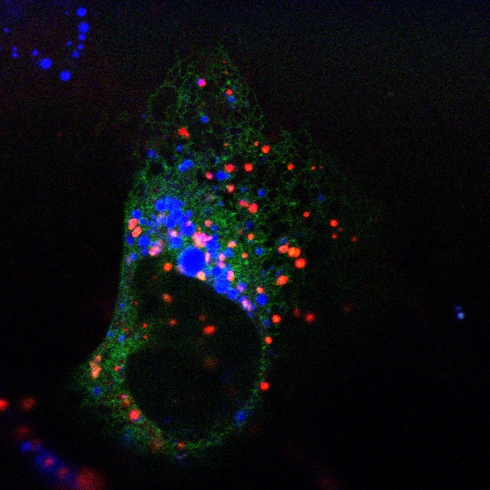 Distribution of lysosomes (red) and lipid droplets (blue) in a human cancer cell